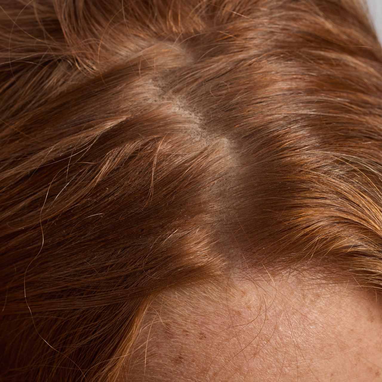 67830-60633-67823-Scalp_HairOilApplicator-Terracotta-Model-Consumables-1-Before-1280x1280px.jpg