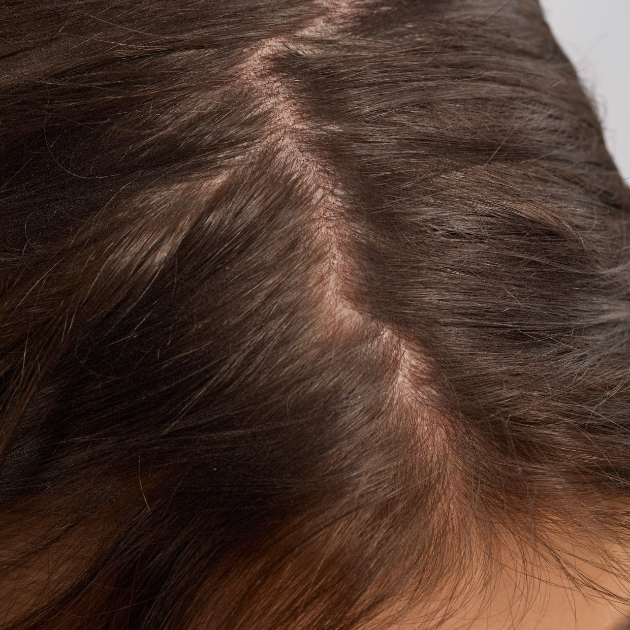 67830-60633-67823-Scalp_HairOilApplicator-Terracotta-Model-Consumables-2-Before-1280x1280px_ffe64ae5-6e12-453f-bbd3-9fb6c8400bcf.jpg